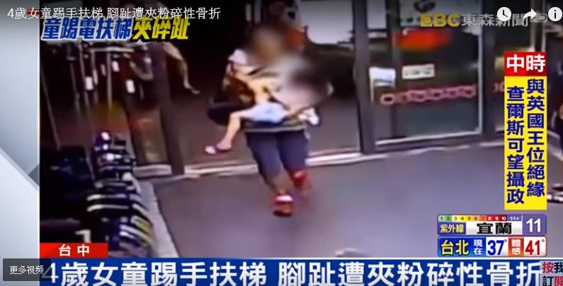 4歲女童被電梯夾到 腳趾粉碎性骨折