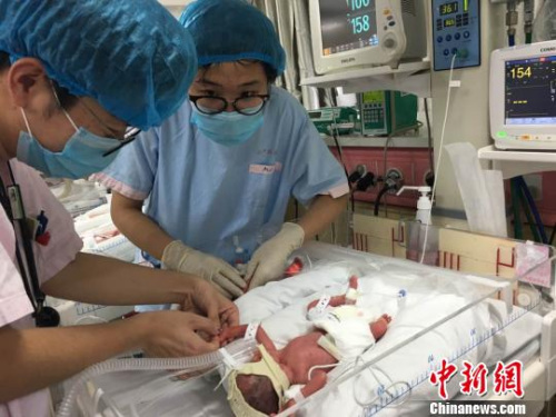 資料圖。上海復旦大學附屬婦産科醫院(紅房子醫院)8日披露，該院剛剛成功接生了同卵四胞胎，四名女嬰和她們的媽媽母女均安。