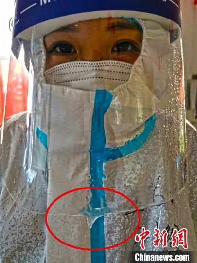 醫護人員長時間堅守在凜冽寒風中，呼出的氣息在隔離面罩上結成了冰霜。圖片由陸軍軍醫大學士官學校附屬醫院提供