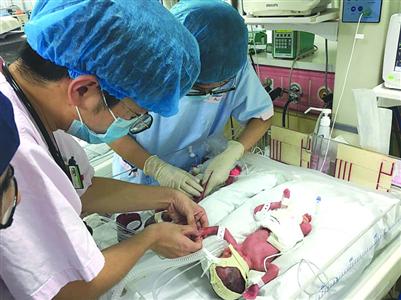 同卵四胞胎姐妹在上海降生 概率僅五十萬分之一