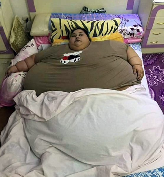 埃及女子重1200斤 將赴印度進行手術減肥