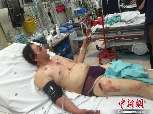 圖為來自廣西柳州的受傷男子。鐘欣 攝